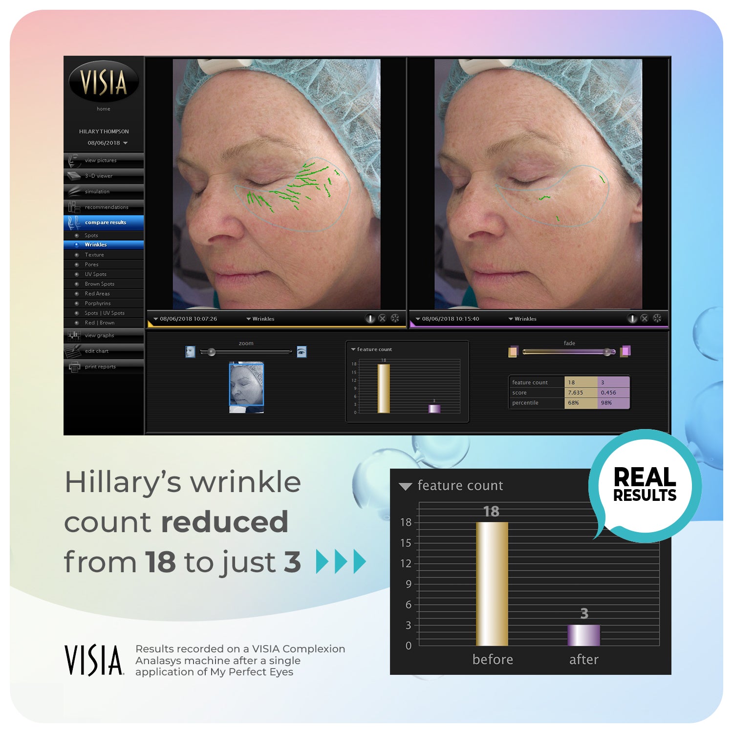 My Perfect Eyes - 10ml