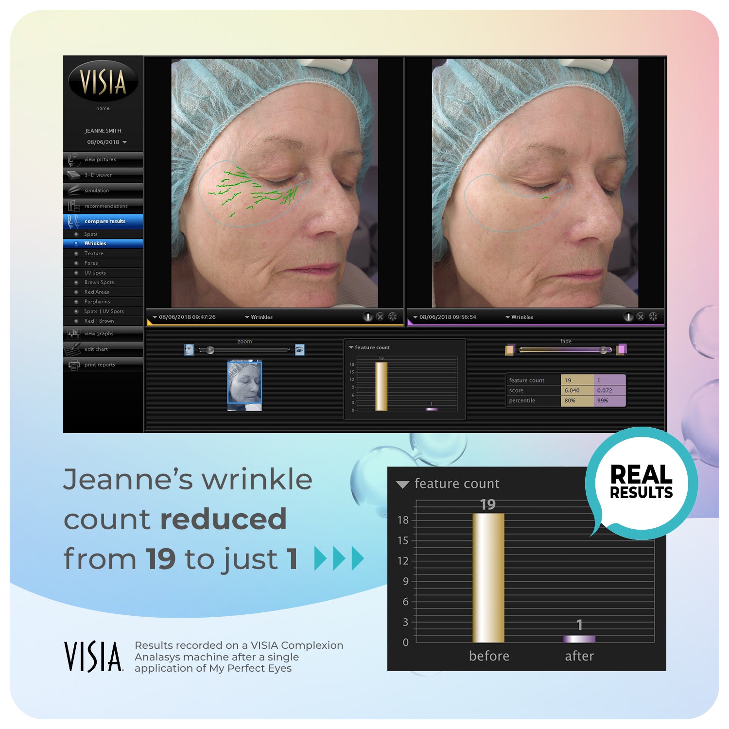 My Perfect Eyes Free Upsize