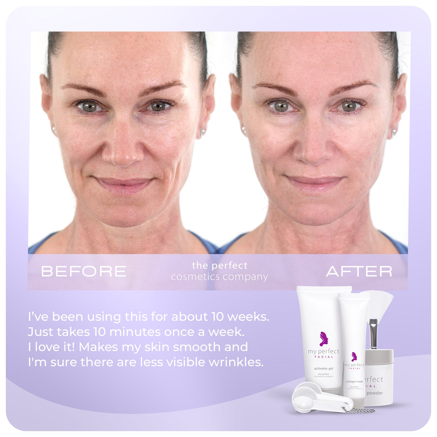 My Perfect Facial 10 + 5 Treatment Bundle