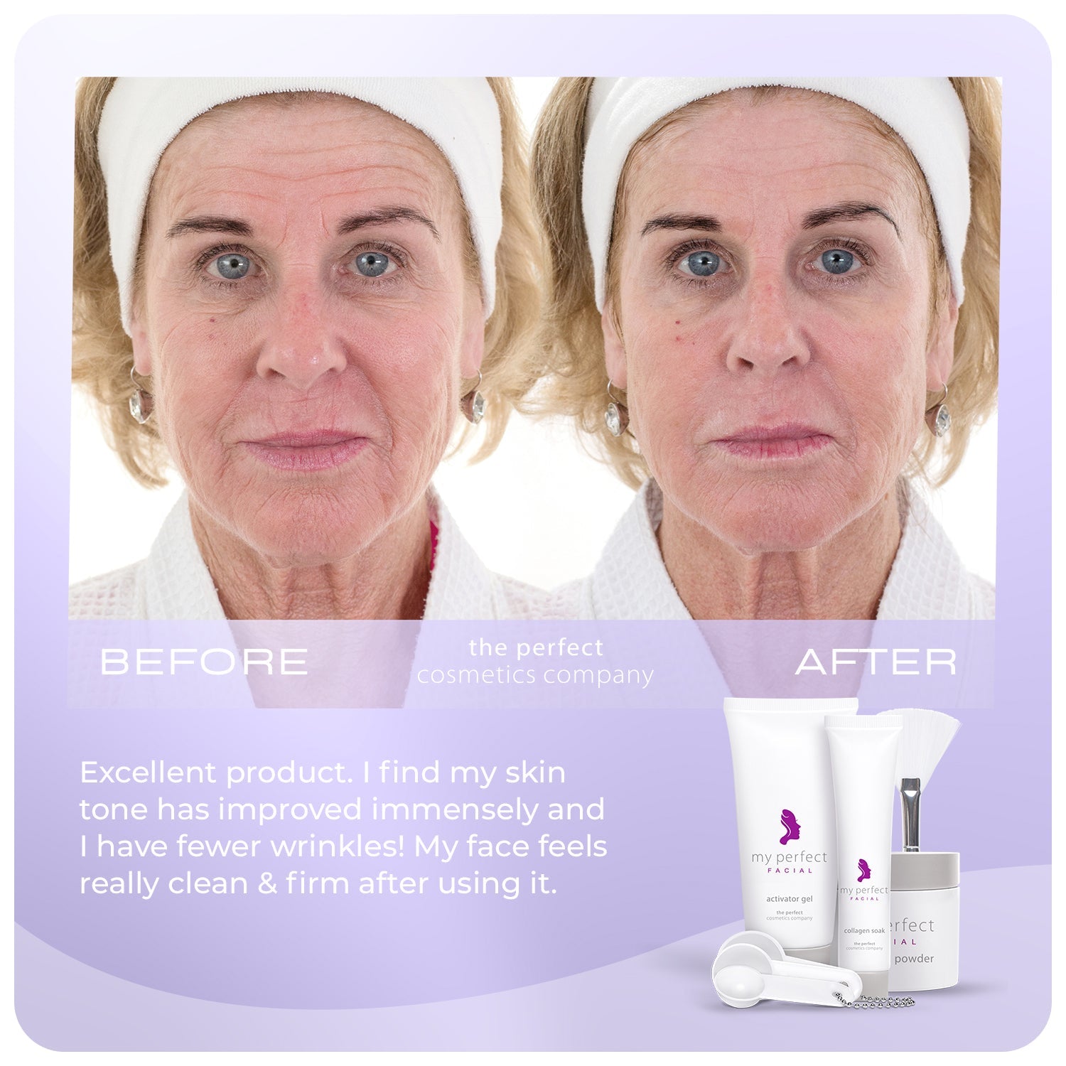 Before and after facial skin smoothing, fine lines and wrinkles, My Perfect Facial results, lifting and firming appearance