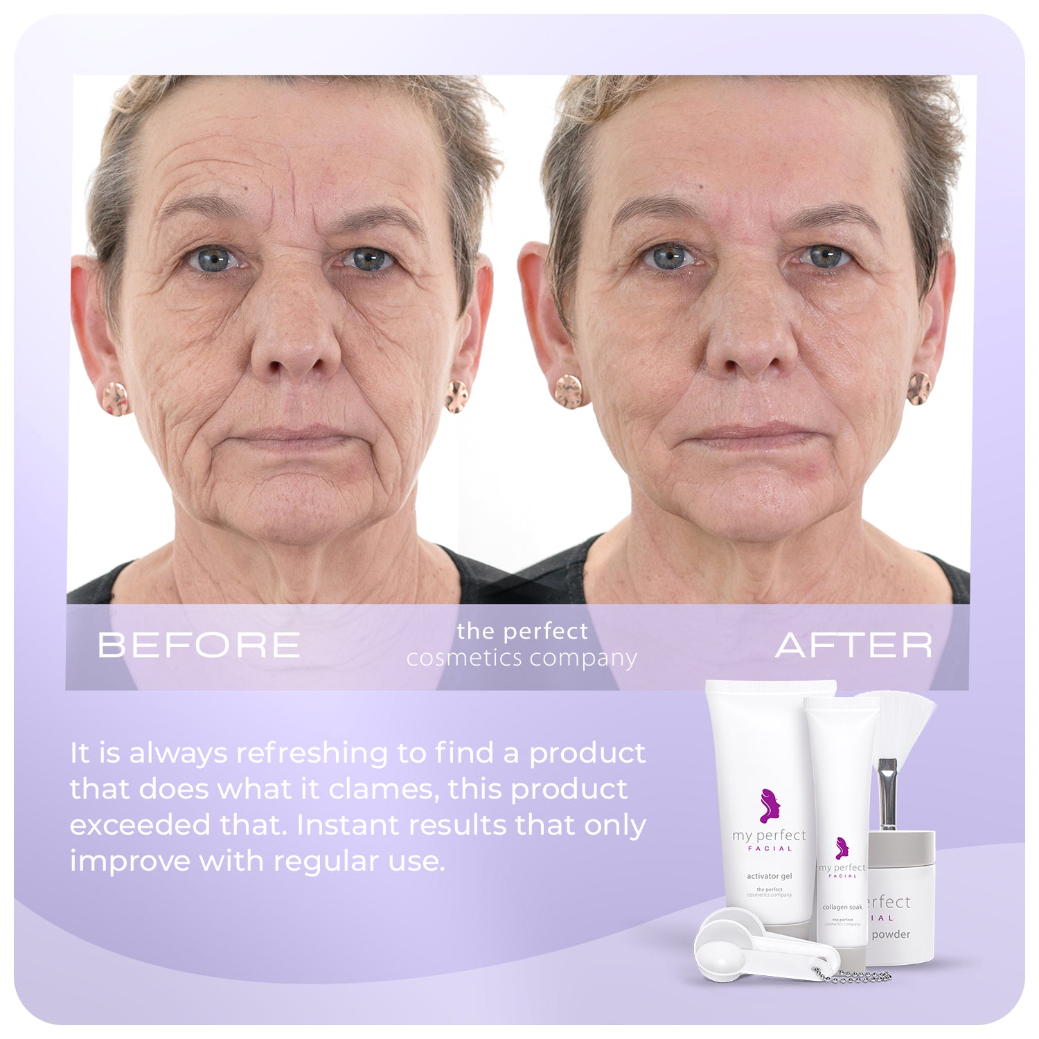 My Perfect Facial 10 + 5 Treatment Bundle