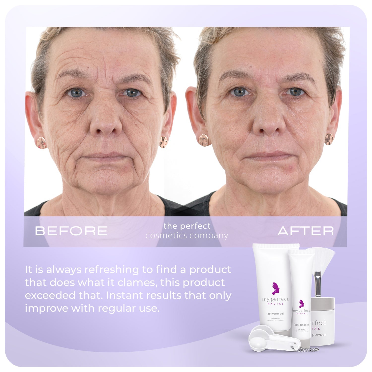 Before and after facial skin smoothing, fine lines and wrinkles, My Perfect Facial results, lifting and firming appearance