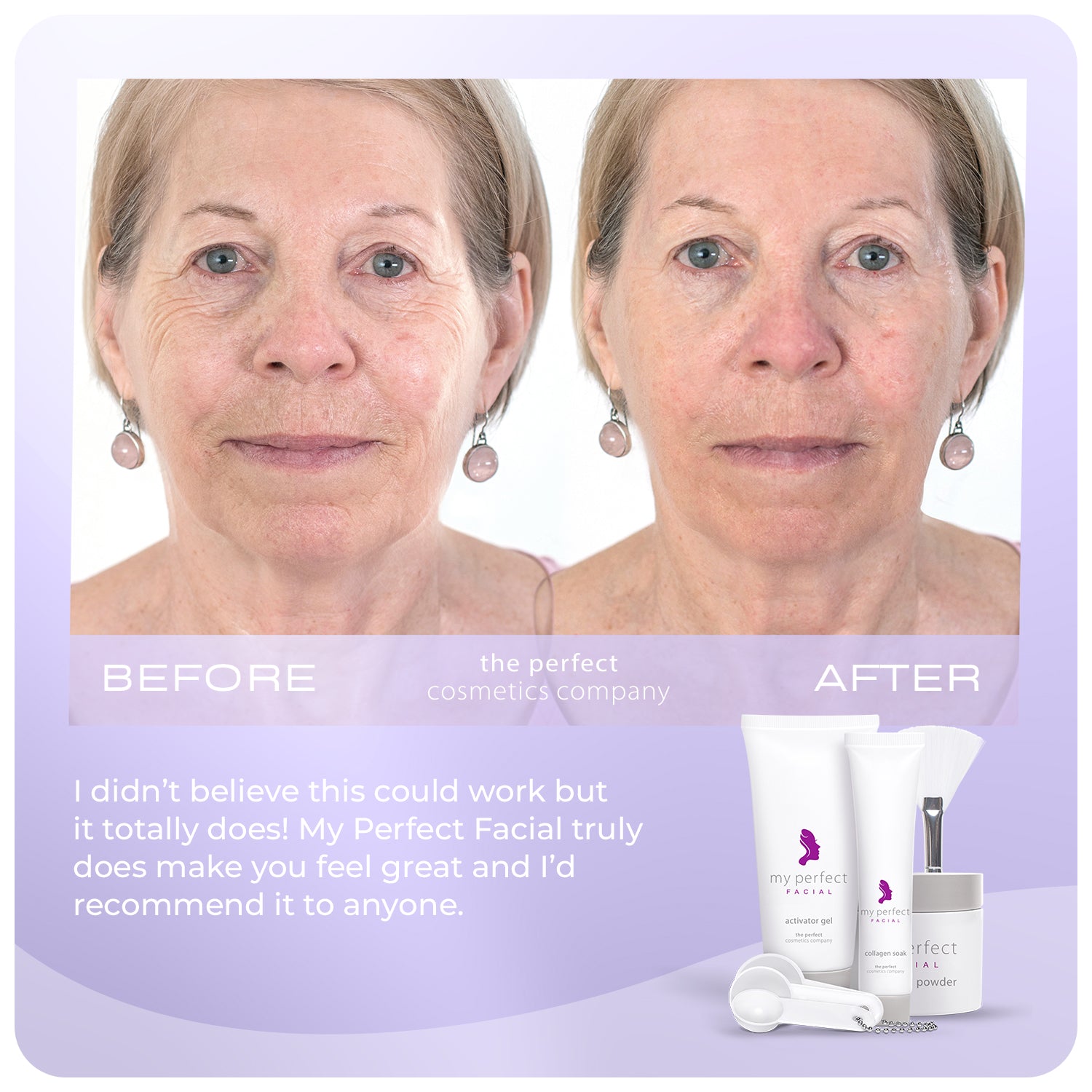 My Perfect Facial 10 + 5 Treatment Bundle