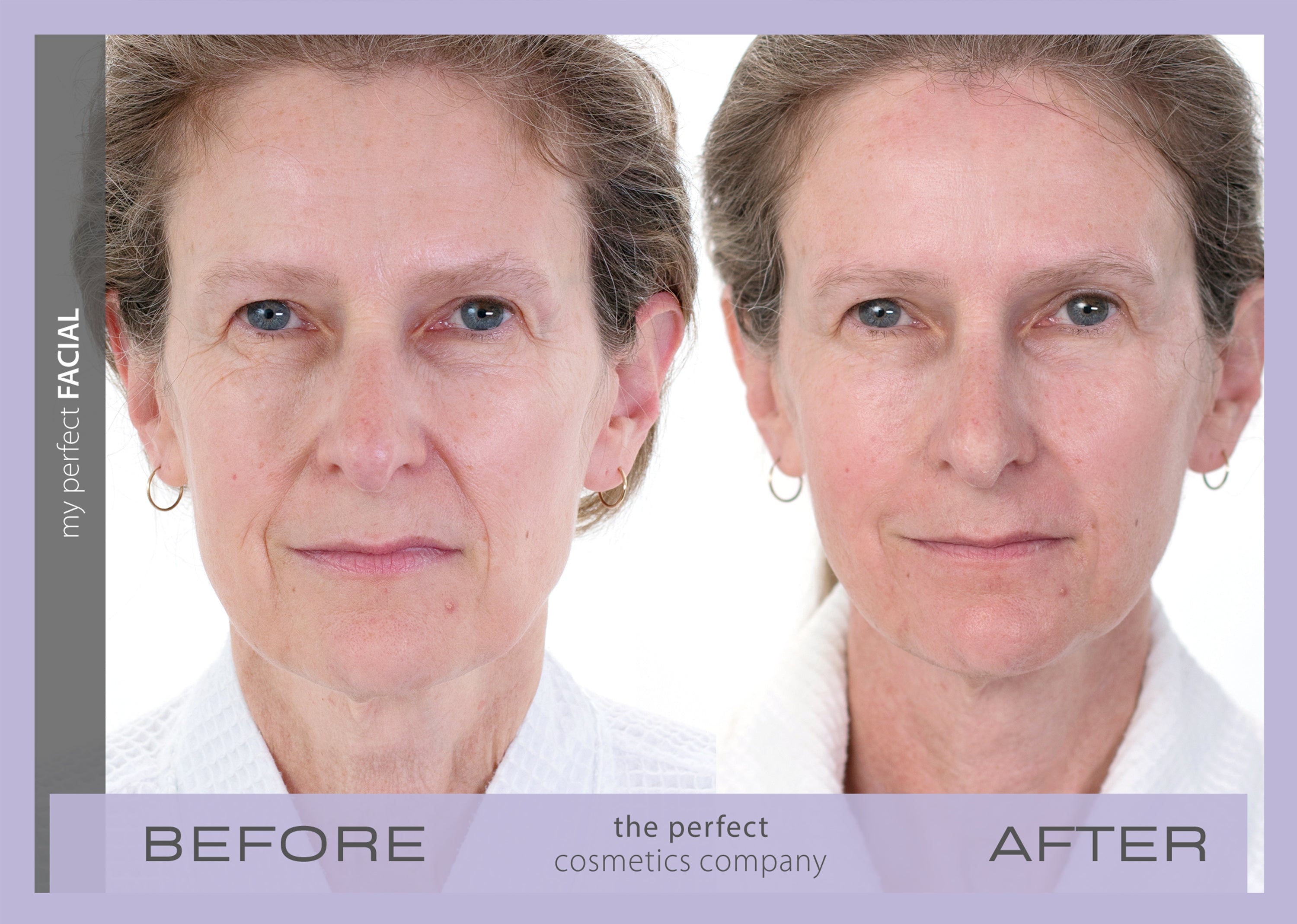 My Perfect Facial before and after results lifting and firming skin, reducing fine lines and wrinkles, improving texture