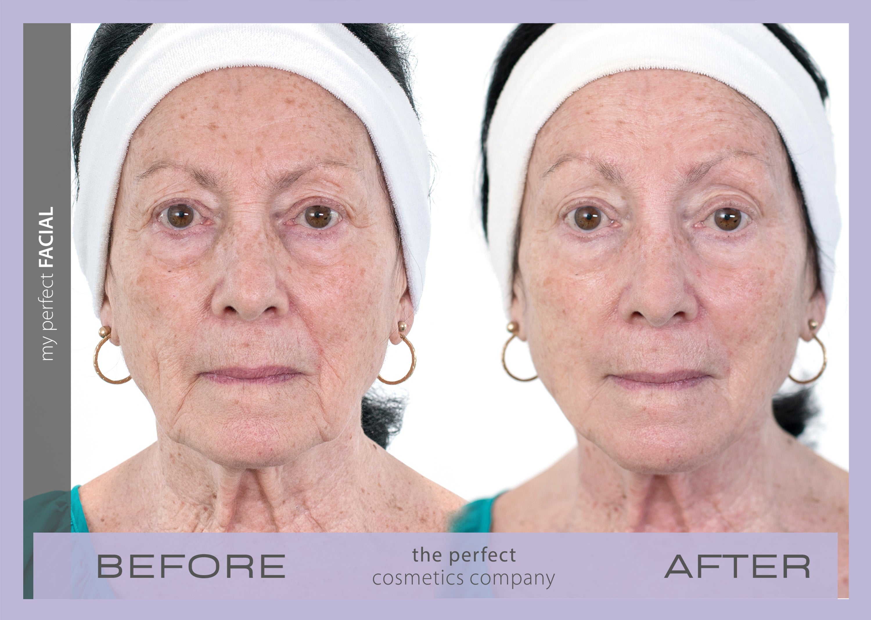 My Perfect Facial before and after results lifting and firming skin, reducing fine lines and wrinkles, improving texture